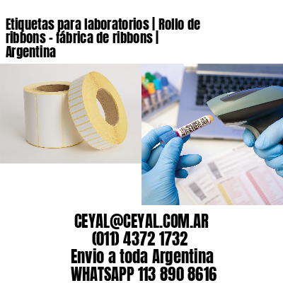 Etiquetas para laboratorios | Rollo de ribbons – fábrica de ribbons | Argentina