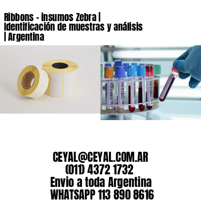 Ribbons – insumos Zebra | Identificación de muestras y análisis | Argentina